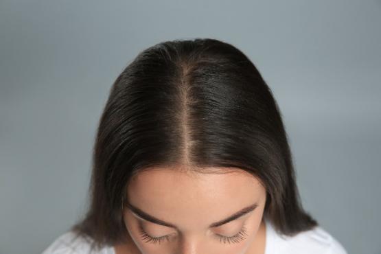 PRP cheveux PRP cheveux