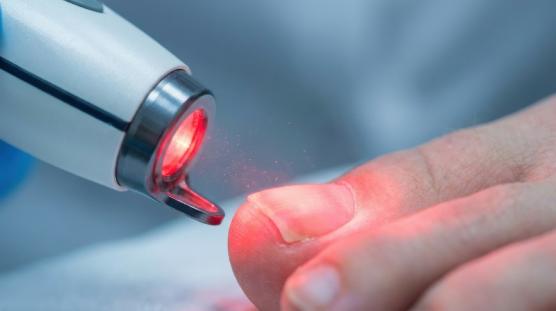 Traitement ongles Traitement ongles