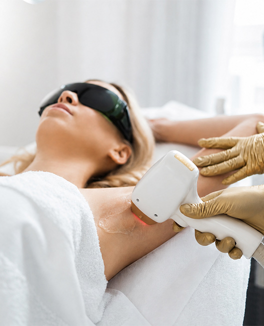 épilation laser